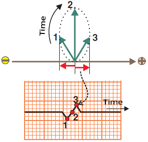 Continuously changing resultant voltage vector during heart cycle and ECG deflection