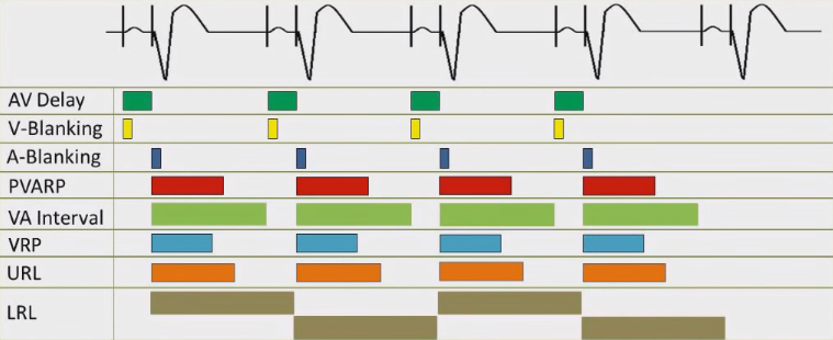 ECG pacemaker timing cycles, AV delay, V-Blanking, A-Blanking, PVARP (Post ventricular atrial refractory period), VA interval, VRP (Ventricular refractory period), URL (Upper rate limit), LRL (Lower rate limit)