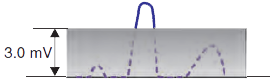 Pacemaker normal sensing