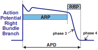 Right bundle branch, APD = action potential duration, ARP = absolute refractory period, RRP = relative refractory period