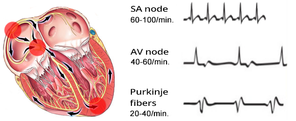 Overdrive suppression phenomenon, Subsidiary pacemakers, SA node - sinus rhythm, AV junction - junctional rhythm, ectopic ventricular focus - ventricular rhythm