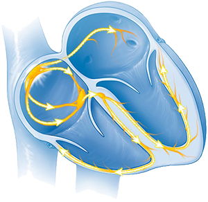 Heart conduction system, sick sinus syndrome