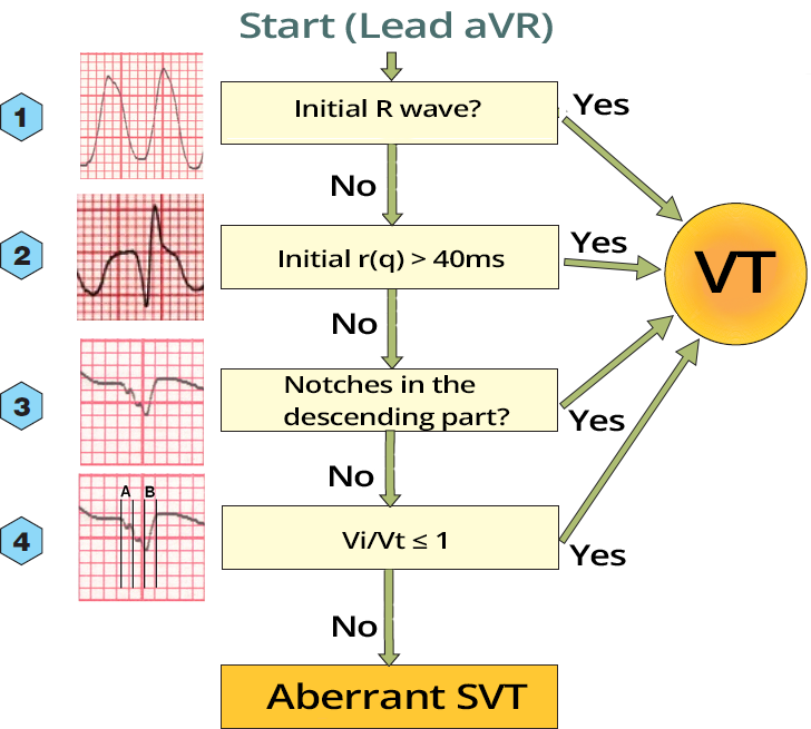 aVR Algorithm (Vereckei) - ECG book