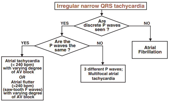 Differential algorithm, diagnosis (DDx), supraventricular (SVT) narrow complex tachycardia, Atrial tachycardia varying AV block, Atrial flutter varying AV block, Multifocal atrial tachycardia, Atrial fibrillation